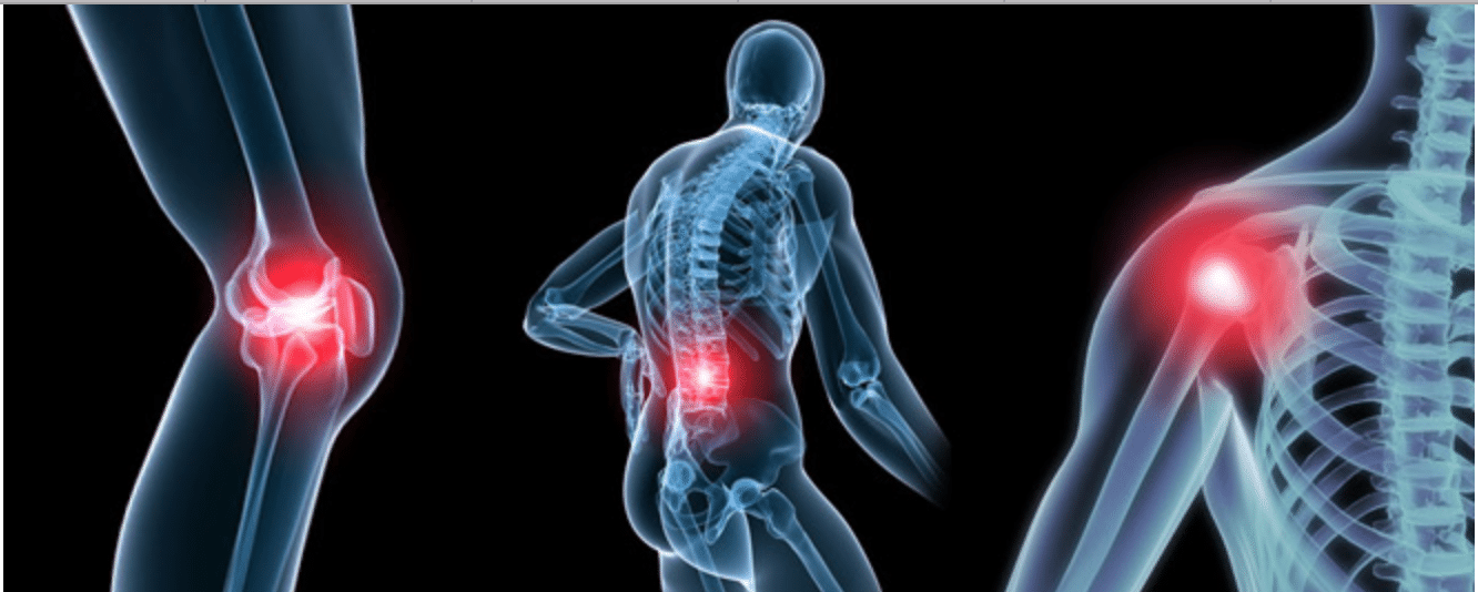 Chill Cryotherapy: Pain + Inflammation Relief For Osteoarthritis