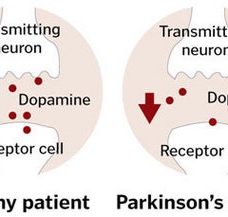 parkinson's dopamine