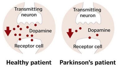 Parkinson's Dopamine